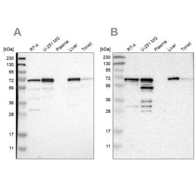 Western Blot: PDLIM5 Antibody [NBP1-84843]