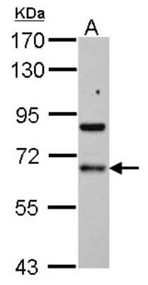 Western Blot: PDLIM5 Antibody [NBP2-19760]