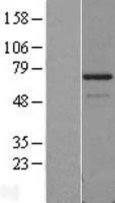 Western Blot: PDLIM5 Overexpression Lysate [NBL1-14257]