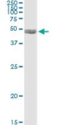 Immunoprecipitation: PDLIM7 Antibody (2D6) [H00009260-M01]