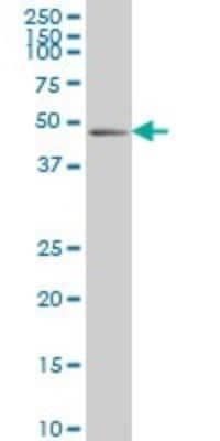 Western Blot: PDLIM7 Antibody (2D6) [H00009260-M01]