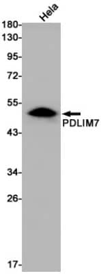 Western Blot: PDLIM7 Antibody (S05-5A1) [NBP3-19734]