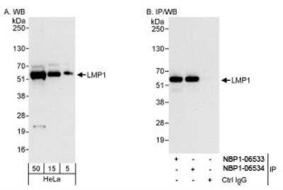 Western Blot: PDLIM7 Antibody [NBP1-06533]