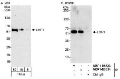 Western Blot: PDLIM7 Antibody [NBP1-06534]