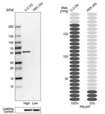 Western Blot: PDLIM7 Antibody [NBP1-84841]