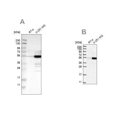 Western Blot: PDLIM7 Antibody [NBP1-84841]