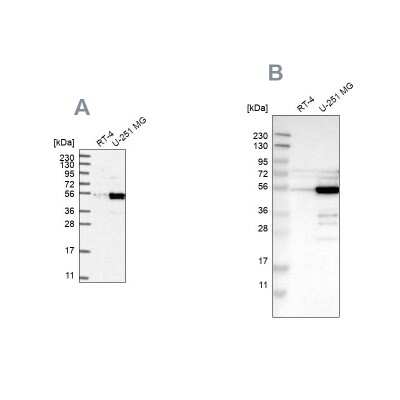 Western Blot: PDLIM7 Antibody [NBP2-58734]