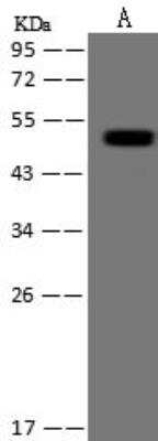 Western Blot: PDLIM7 Antibody [NBP3-12641]