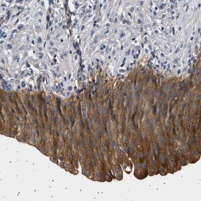 Immunohistochemistry-Paraffin: PDP1/PPAPDC2 Antibody [NBP1-83443]