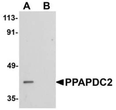 Western Blot: PDP1/PPAPDC2 AntibodyBSA Free [NBP1-76245]