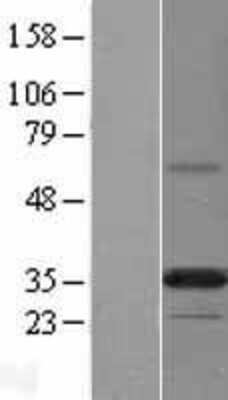 Western Blot: PDP1/PPAPDC2 Overexpression Lysate [NBL1-14629]