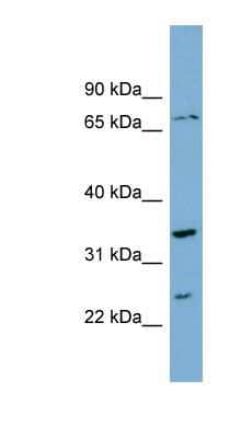 Western Blot: PDP2 Antibody [NBP1-55463]