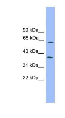 Western Blot: PDP2 Antibody [NBP1-57641]