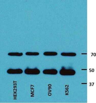 Western Blot: PDP2 Antibody [NBP1-82912]