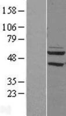 Western Blot: PDP2 Overexpression Lysate [NBL1-14258]