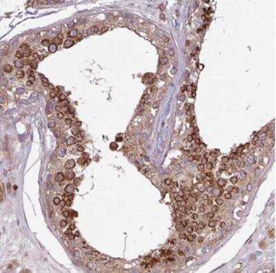 Immunohistochemistry: PDP3 Antibody [NBP2-30373]