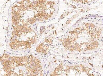 Immunohistochemistry-Paraffin: PDP3 Antibody [NBP3-05795]