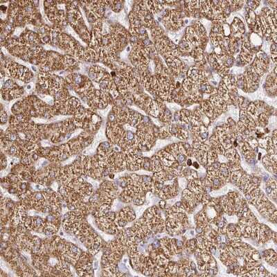 Immunohistochemistry-Paraffin: PDK-1 Antibody [NBP2-48631]