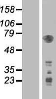 Western Blot: PDK-1 Overexpression Lysate [NBL1-14259]