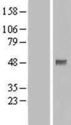 Western Blot: PDK-1 Overexpression Lysate [NBL1-14260]