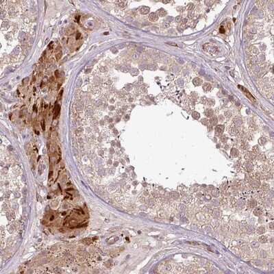 Immunohistochemistry-Paraffin: PDRG1 Antibody [NBP2-13746]