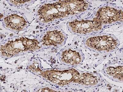 Immunohistochemistry-Paraffin: PDRG1 Antibody [NBP3-00250]