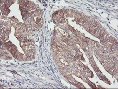 Immunohistochemistry: PDRG1 Antibody (OTI4F12) - Azide and BSA Free [NBP2-73320]