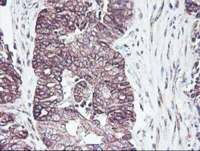 Immunohistochemistry: PDRG1 Antibody (OTI4F12) - Azide and BSA Free [NBP2-73320]