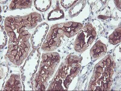 Immunohistochemistry: PDRG1 Antibody (OTI4F12) - Azide and BSA Free [NBP2-73320]