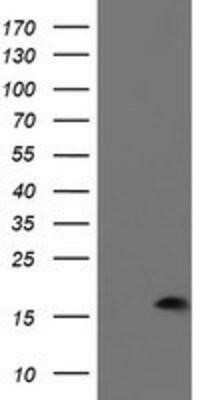 Western Blot: PDRG1 Antibody (OTI4F12)Azide and BSA Free [NBP2-73320]