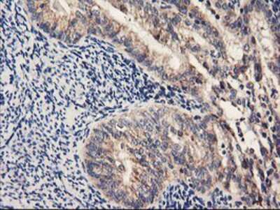Immunohistochemistry-Paraffin: PDSS2 Antibody (OTI1D12) [NBP2-01512]