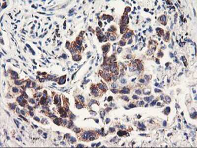Immunohistochemistry-Paraffin: PDSS2 Antibody (OTI1D12) [NBP2-01512]