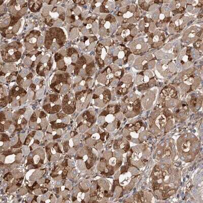 Immunohistochemistry-Paraffin: PDSS2 Antibody [NBP1-88739]