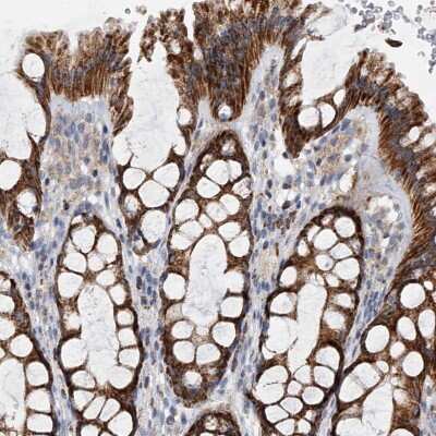 Immunohistochemistry-Paraffin: PDSS2 Antibody [NBP1-88740]