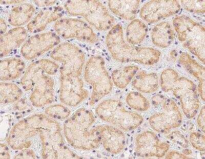 Immunohistochemistry-Paraffin: PDSS2 Antibody [NBP3-12590]