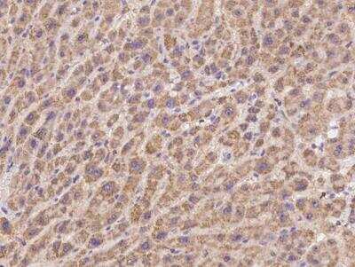Immunohistochemistry-Paraffin: PDSS2 Antibody [NBP3-12590]