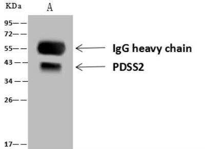 Immunoprecipitation: PDSS2 Antibody [NBP3-12590]