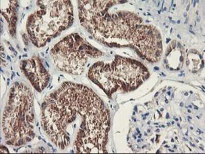 Immunohistochemistry: PDSS2 Antibody (OTI1D12) - Azide and BSA Free [NBP2-73323]