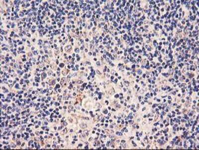 Immunohistochemistry: PDSS2 Antibody (OTI1D12) - Azide and BSA Free [NBP2-73323]