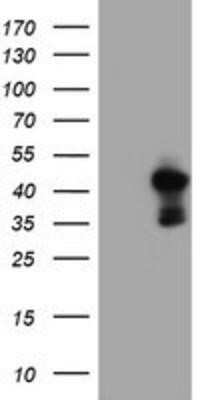 Western Blot: PDSS2 Antibody (OTI1D12)Azide and BSA Free [NBP2-73323]