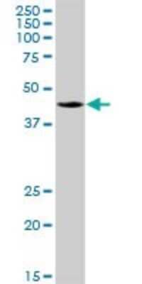 Western Blot: PDSS2 Antibody [H00057107-B01P]