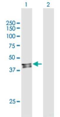 Western Blot: PDSS2 Antibody [H00057107-B01P]