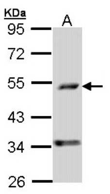 Western Blot: PDSS2 Antibody [NBP1-33199]