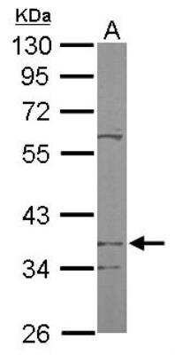 Western Blot: PDSS2 Antibody [NBP1-33199]