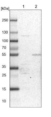 Western Blot: PDSS2 Antibody [NBP1-88739]