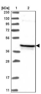 Western Blot: PDSS2 Antibody [NBP1-88740]