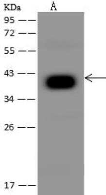 Western Blot: PDSS2 Antibody [NBP3-12590]