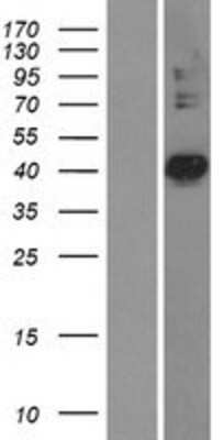 Western Blot: PDSS2 Overexpression Lysate [NBL1-14265]