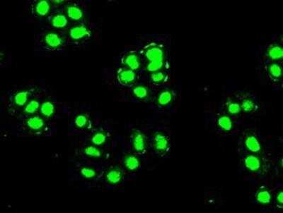 Immunocytochemistry/ Immunofluorescence: PDX-1/IPF1 Antibody (OTI2A12) [NBP1-47910]