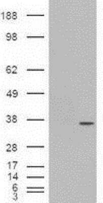 Western Blot: PDX-1/IPF1 Antibody (OTI2A12) [NBP1-47910]